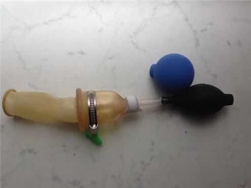 Σπιτική μεγέθυνση πέους